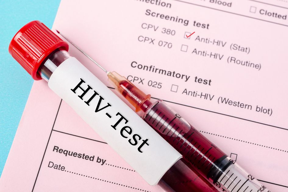 Berita Mencegah Hiv Terbaru Hari Ini Parapuan