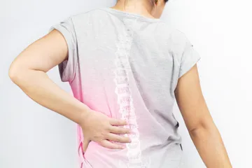 Ilustrasi osteoporosis