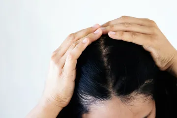 Jangan Sembarangan, Hindari 5 Kebiasaan Ini saat Merawat Rambut Tipis