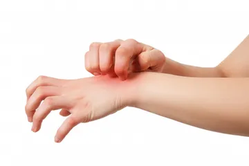 Tips menghilangkan tungau debu di rumah.