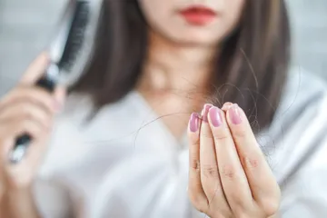 4 penyebab terjadinya alopecia