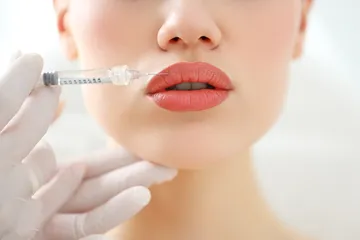 Perawatan lip injection dengan hyaluronic acid