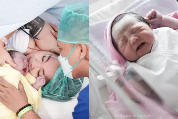 Putri Arief Muhammad dan Tiara Pangestika lahir dengan 2 gigi