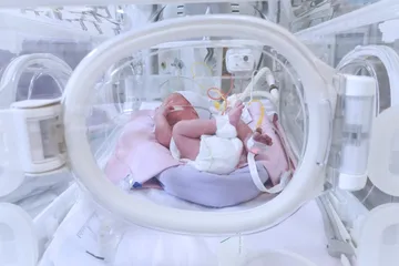 Kehamilan yang tidak diinginkan bisa menyebabkan kelahiran bayi prematur