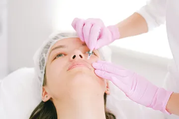 Aturan perawatan wajah setelah chemical peeling