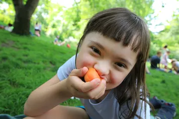 Kebutuhan nutrisi untuk anak down syndrome