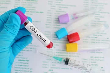 Tes HIV ditanggung oleh BPJS