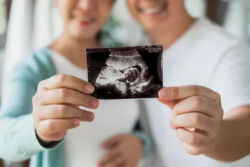 Program hamil untuk pasangan suami istri