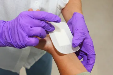 Dokter viral di Tiktok bagikan tips merawat luka agar tidak berbekas