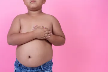 Tanda obesitas pada anak yang perlu diwaspadai