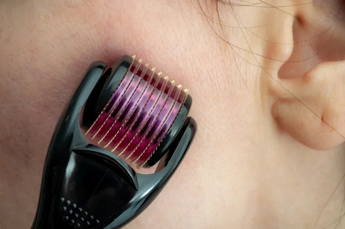 Mengenal apa itu dermaroller yang sempat viral karena klink kecantikan abal-abal.