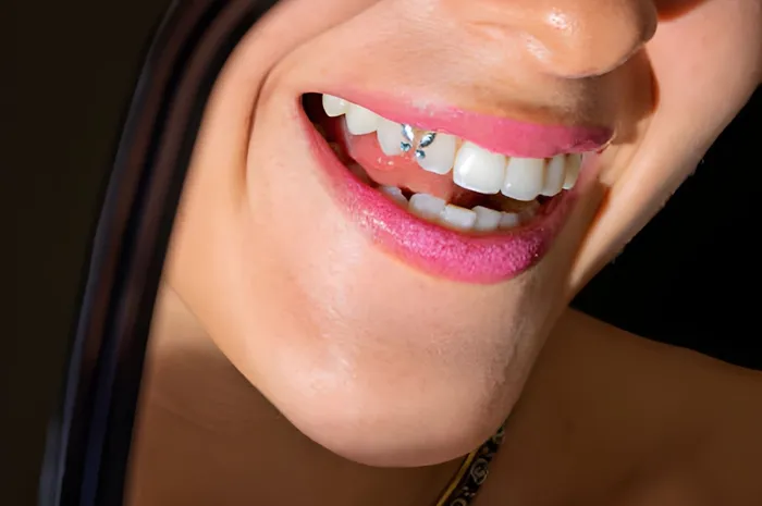 Hiasan Gigi Berkilau Tooth Gems Jadi Tren, Aman untuk Dicoba? - …