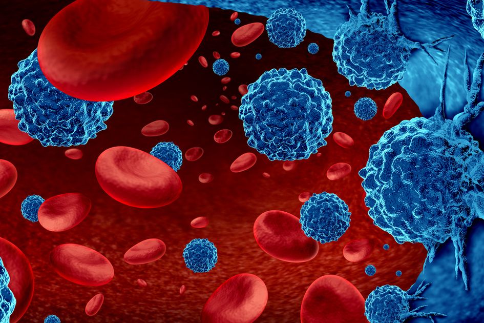 Tingkatkan Harapan Hidup, Kenali Teknologi Terkini Pengobatan Kanker Darah