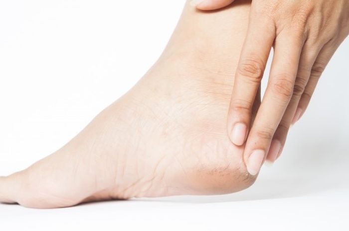 Tak hanya krim yang dijual di luaran, kamu juga bisa mengatasi masalah kaki pecah-pecah dengan ramuan buatan sendiri loh.