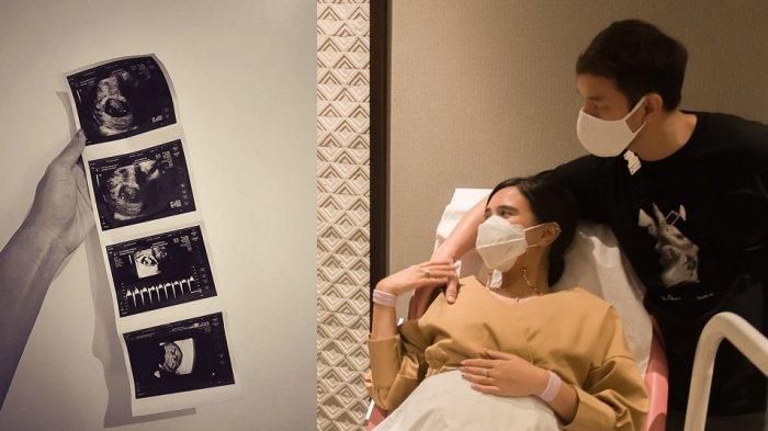 Selamat! Audi Marissa resmi menjadi seorang ibu. Namun ia terpaksa harus melahirkan prematur. Begini kondisi bayinya...