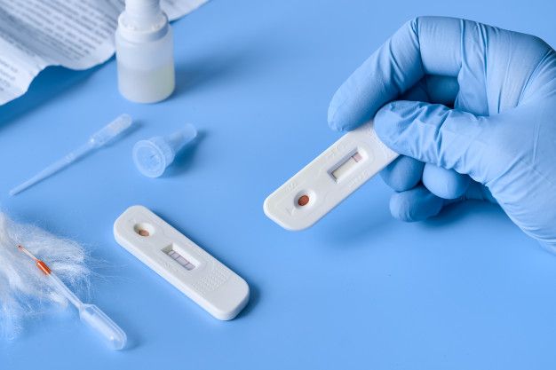 Heboh penggunaan alat rapid antigen bekas di Bandara Kualanamu Medan. Begini pendapat epidemiolog terkait bahaya penggunaan alat rapid antigen bekas. 