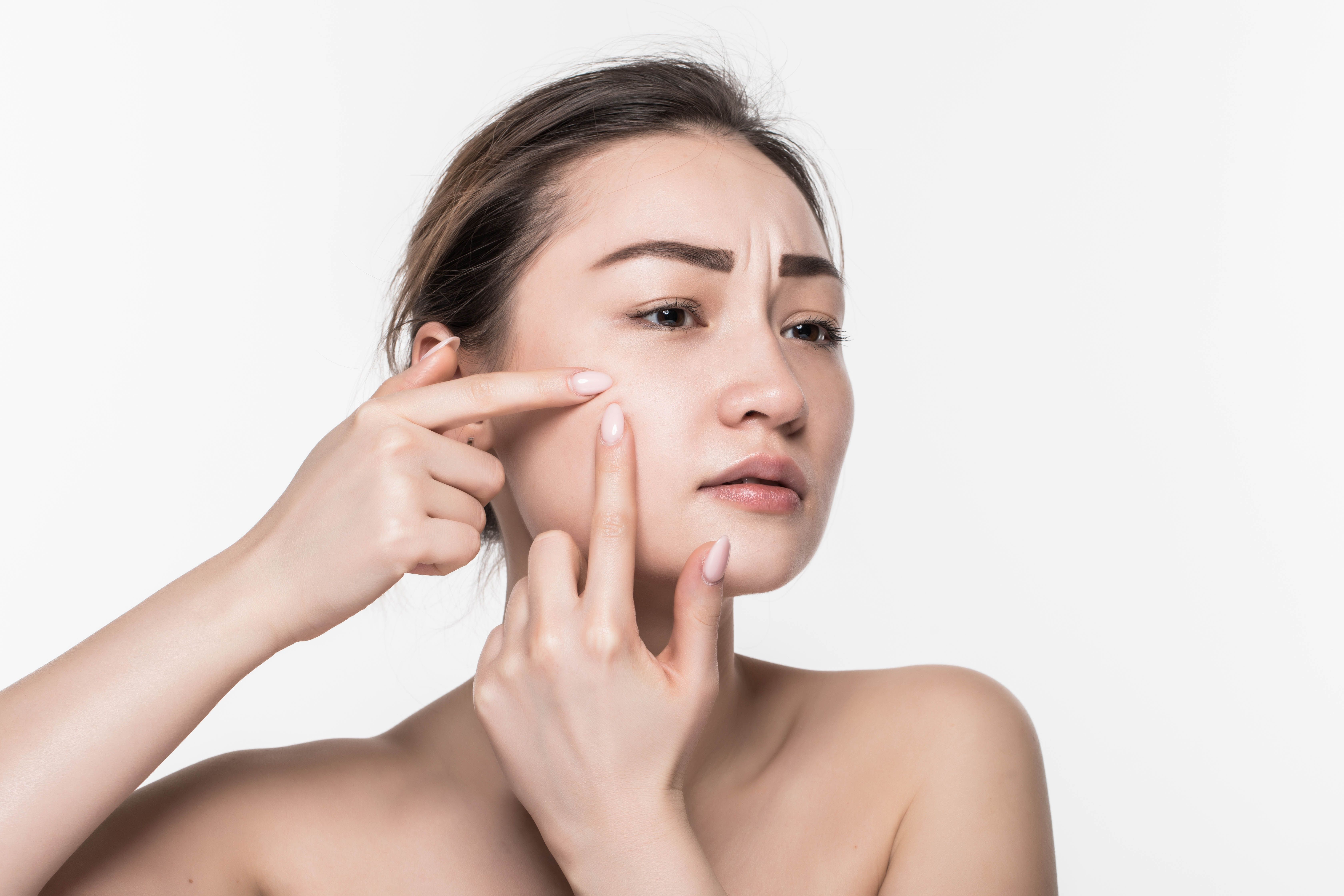 Apa saja bahan aktif skincare yang sebaiknya dihindari oleh pemilik kulit sensitif? Simak lengkapnya berikut, salah satunya ada retinol.