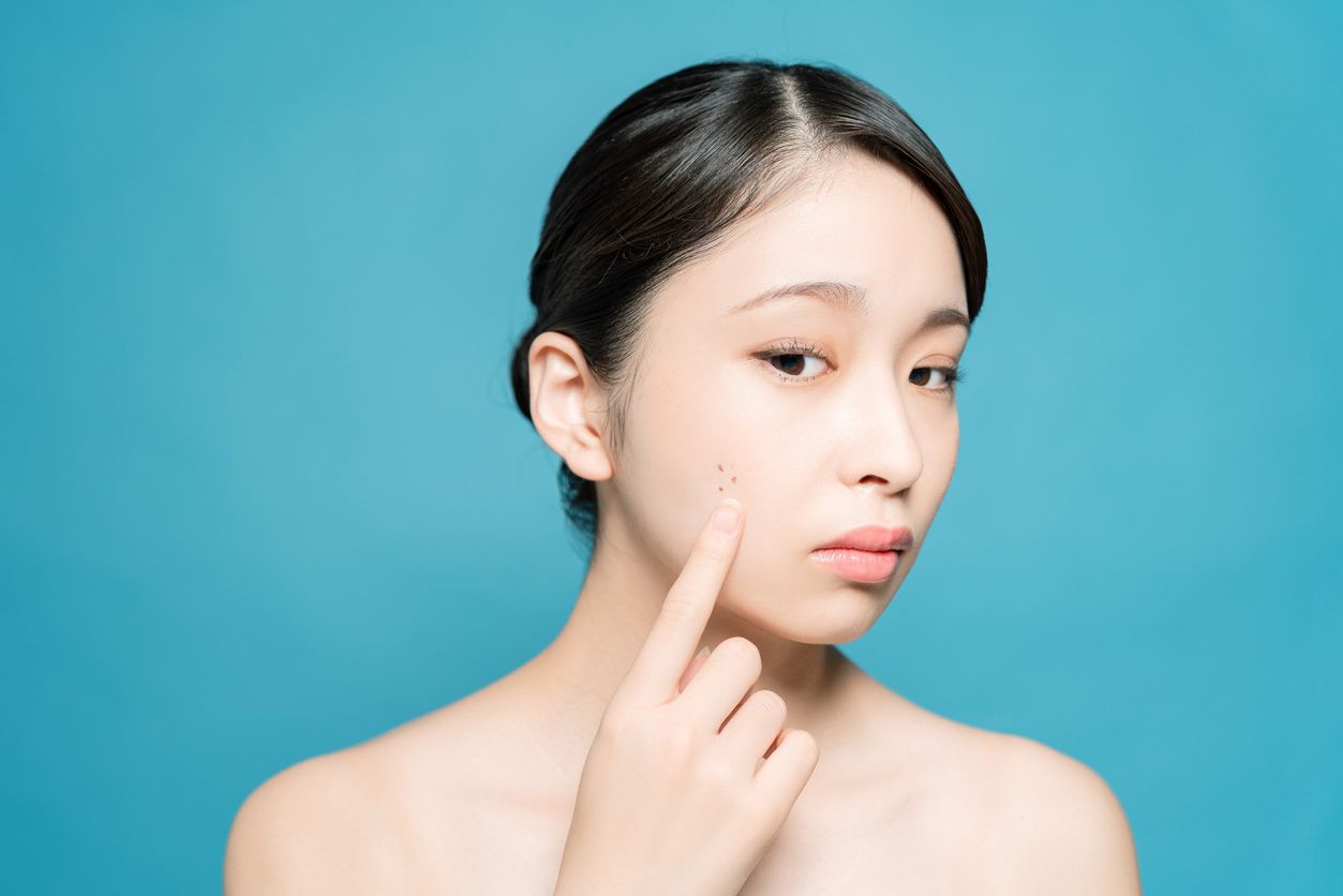 Tahukah kamu bahwa mood dapat berpengaruh pada kesehatan kulit? Seperti stres dapat membuat kulit kering dan mengalami penuaan lebih cepat.