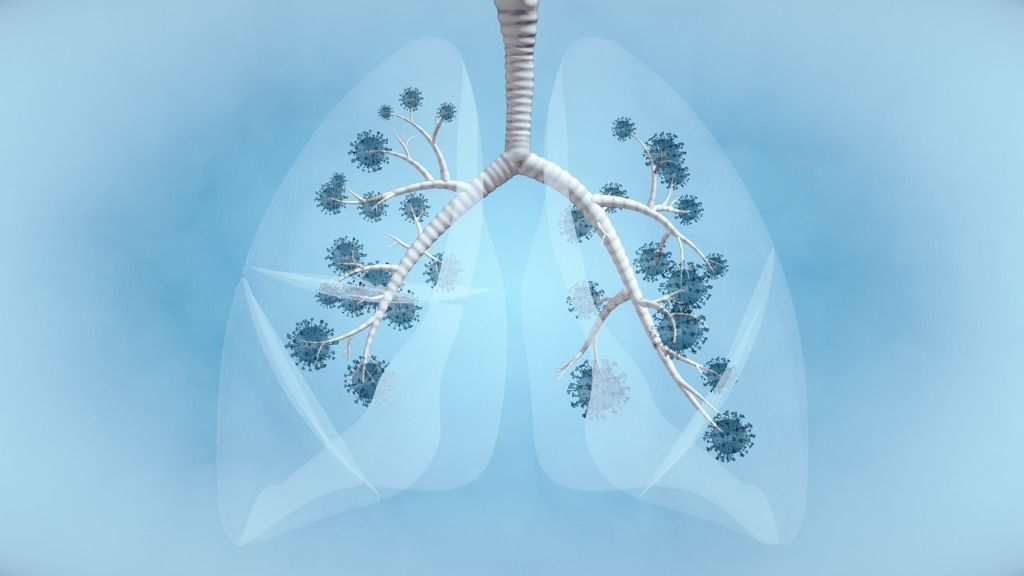 Berita terpopuler di kanal Wellness. Mulai dari hari tuberkulosis sedunia hingga mitos dan fakta ibu hamil saat puasa