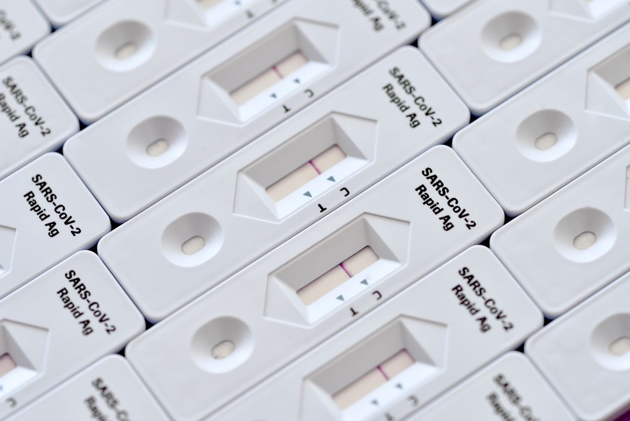 Melalui Kementerian Kesehatan (Kemenkes), pemerintah telah menetapkan batas tarif tertinggi pemeriksaan tes rapid antigen. Ini rinciannya. 