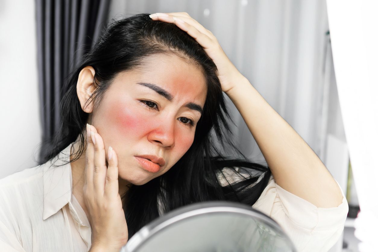Meskipun sudah memakai sunblock, terkadang kita sering kecolongan hingga mengakibatkan sunburn. Ini dia cara mudah mengatasinya.