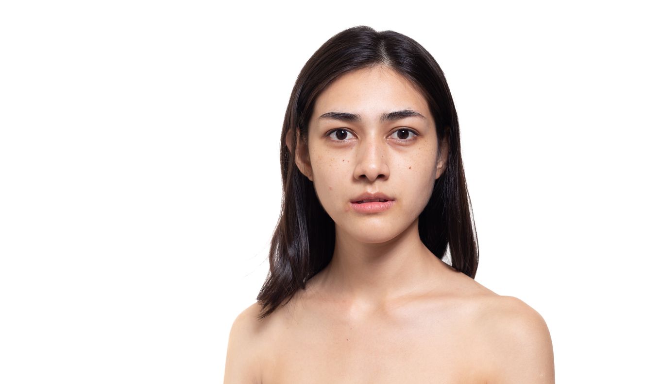 Tak cuma jerawat, kulit kusam juga merupakan masalah yang paling sering menimpa perempuan. Apa saja penyebabnya?