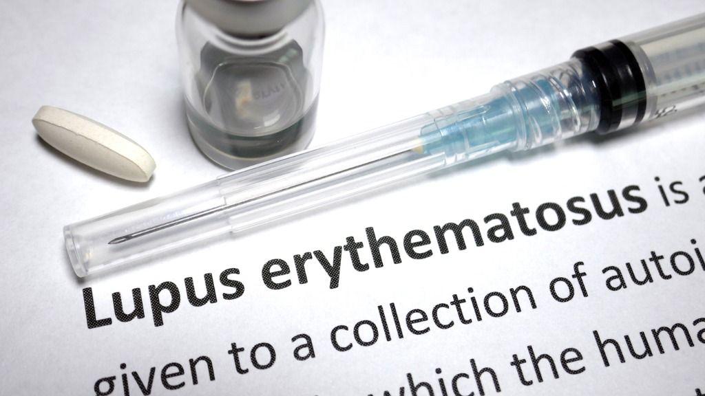 Dokter ungkap bahwa penderita penyakit lupus itu hidup dengan penuh tantangan di tengah pandemi Covid-19, ini penjelasannya.