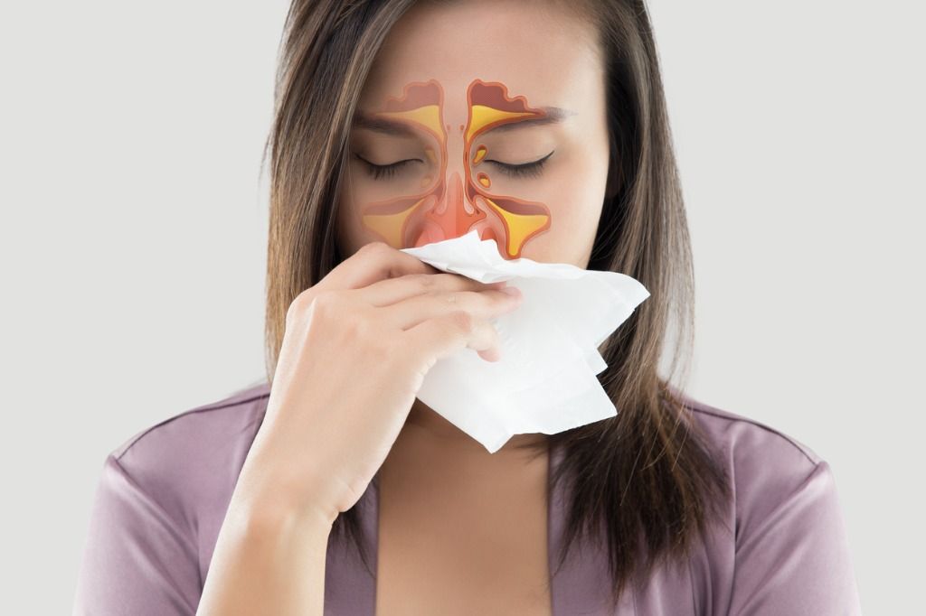Berikut ini empat tipe sinusitis yang digolongkan berdasarkan penyebabnya, yuk simak penjelasannya lebih lanjut