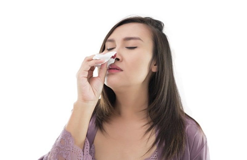 Mimisan merupakan kondisi di mana pembuluh darah permukaan di hidung berdarah. Lalu apa penyebab terjadinya mimisan secara tiba-tiba?