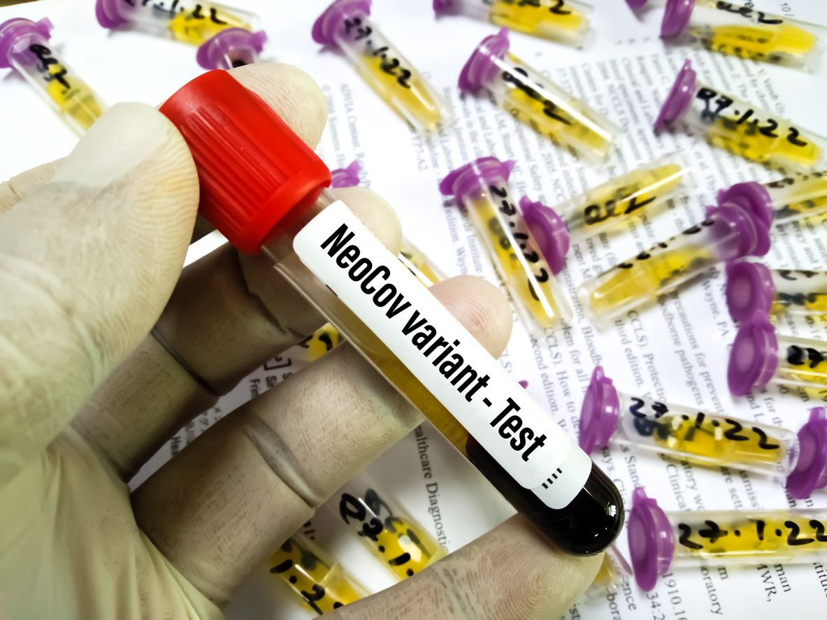 Ilmuan Tiongkok berhasil menemukan jenis virus Corona terbaru, bernama NeoCov. Apakah benar merupakan varian terbaru dari Covid-19?