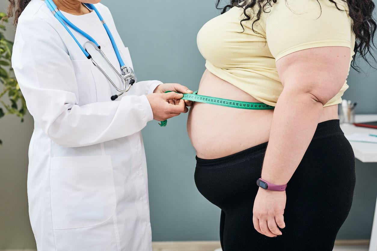 Catat ya, berikut ini lima hal yang menjadi penyebab obesitas dari makanan dan aktivitas fisik hingga stres.
