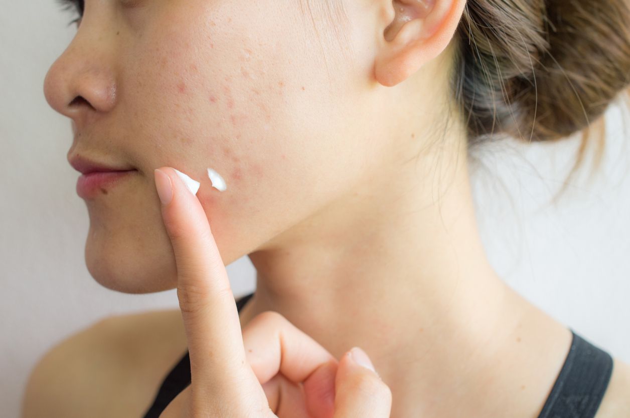 Ini dia cara mengaplikasikan skincare viral di TikTok untuk mencegah masalah pori-pori membesar menurut ahli. Apa saja?