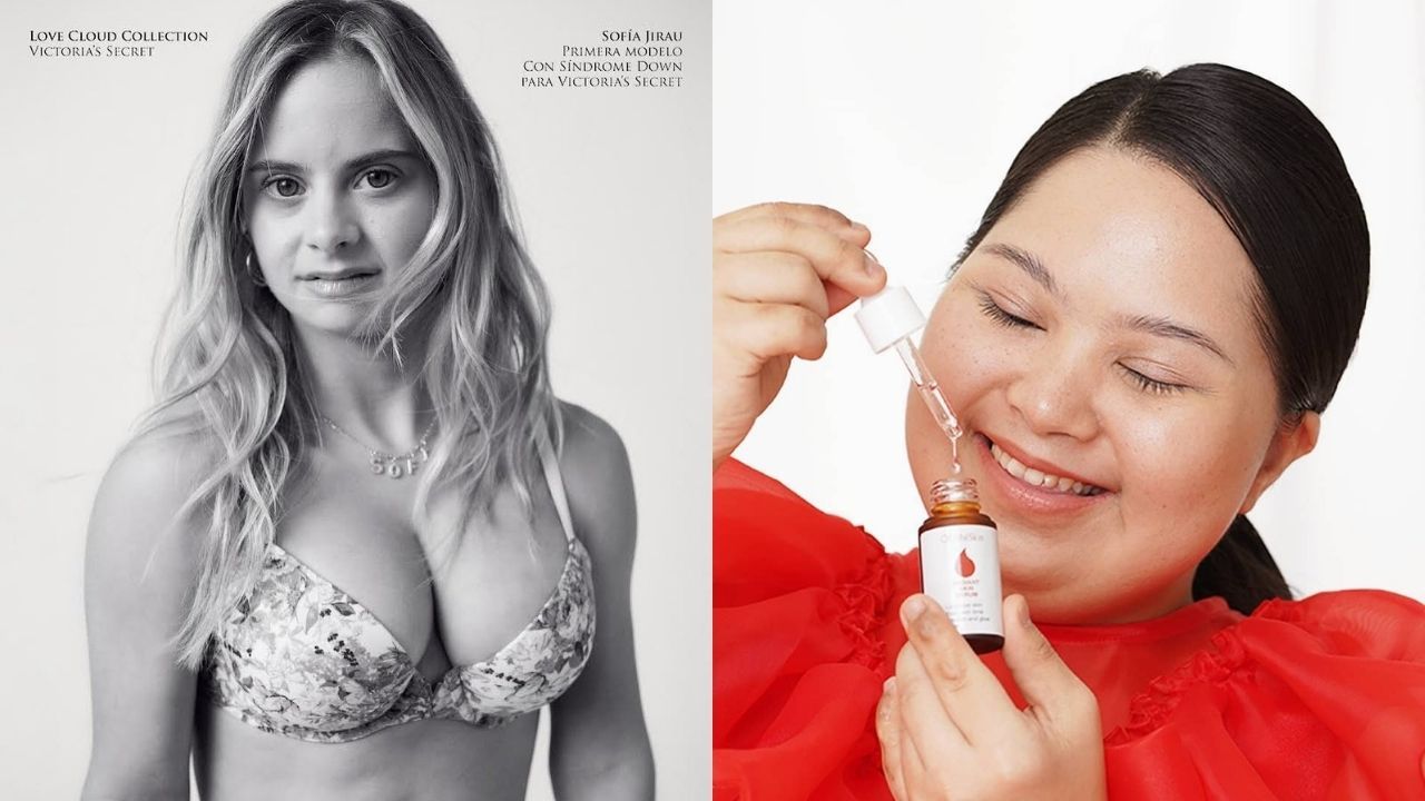 Berikut deretan model down syndrome yang berhasil digandeng brand fashion hingga kecantikan. Ada Sofia Jirau!