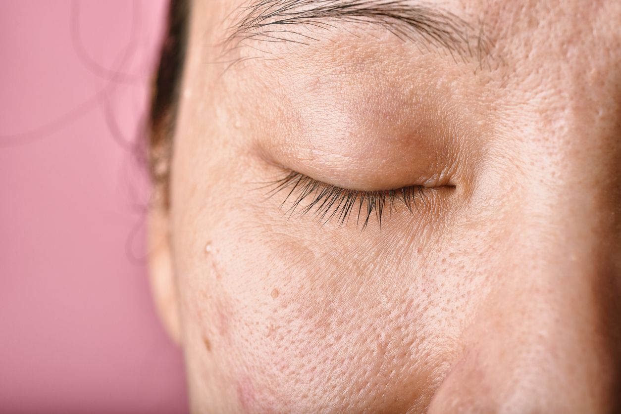 Atasi kulit dehidrasi saat puasa agar tampak glowing ketika hari Lebaran dengan skincare ini. Di sisi lain, jangan lupa jaga asupan makanan, ya! 