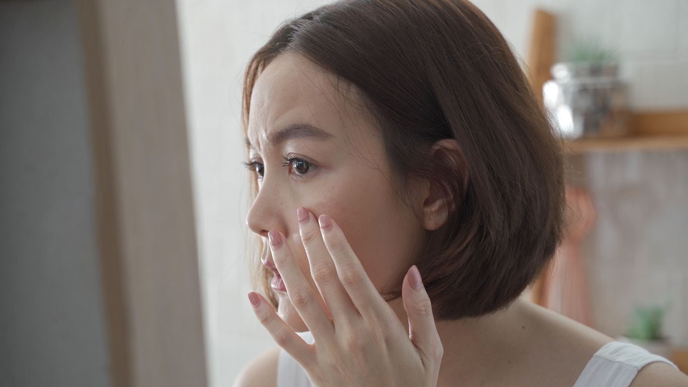 Ternyata ini alasan purging bisa terjadi pada kulit serta kandungan aktif skincare yang bisa menyebabkannya menurut dokter.