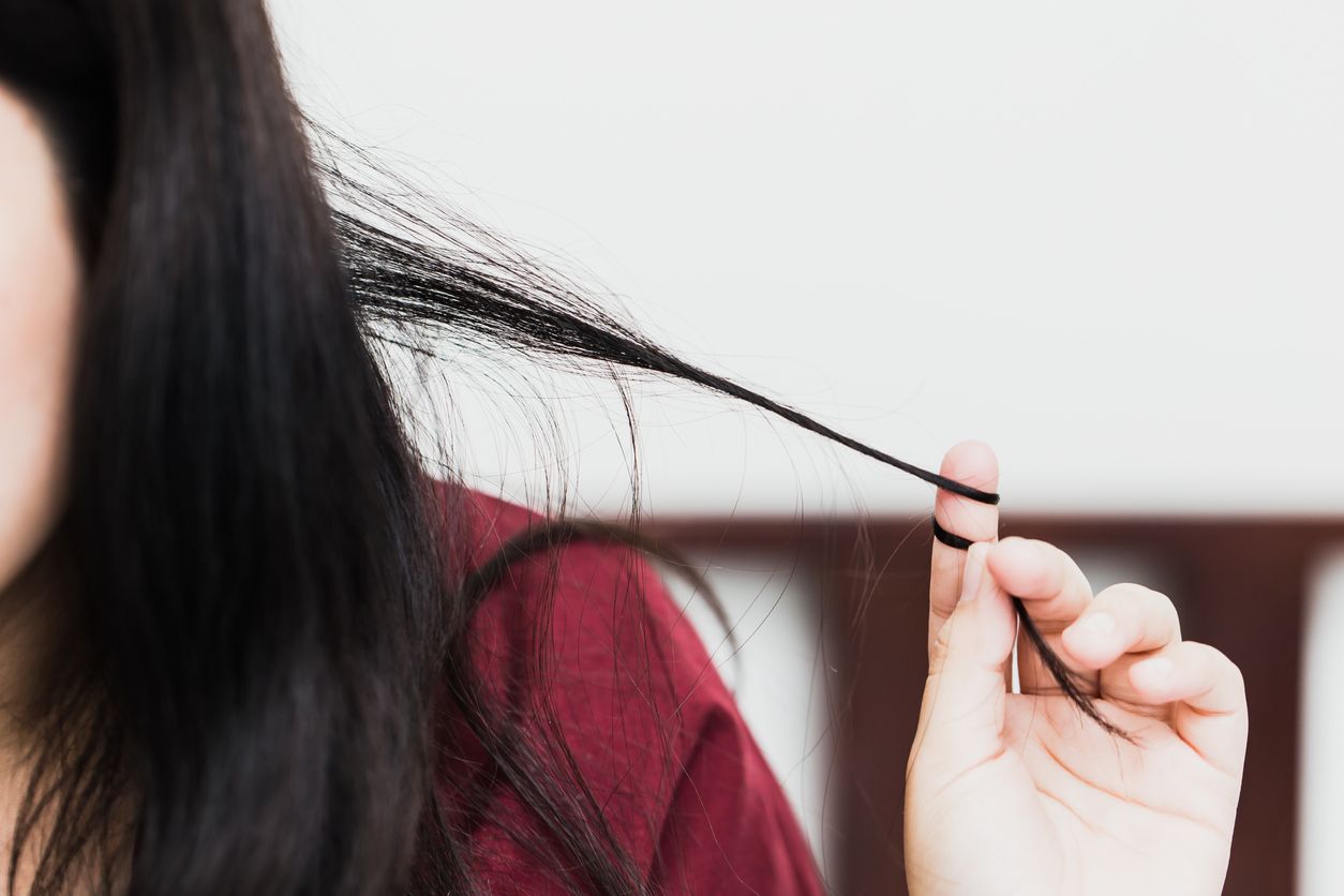 Trikotilomania merupakan gangguan mental dengan mencabut rambut sendiri. Simak, berikut penyebab dan gejalanya.