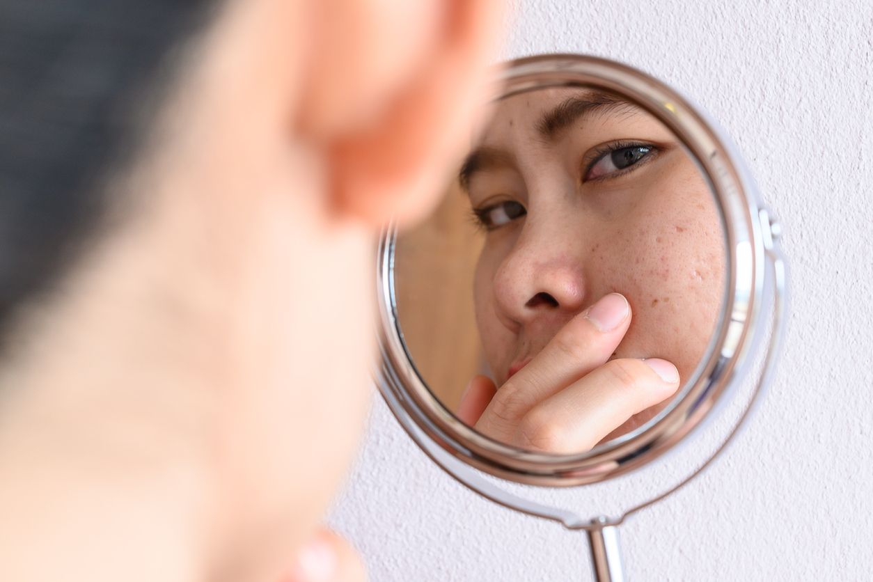 Produk dari brand Skintific belakangan jadi skincare viral di TikTok. Simak rekomendasi produknya yang cocok untuk perkuat skin barrier.