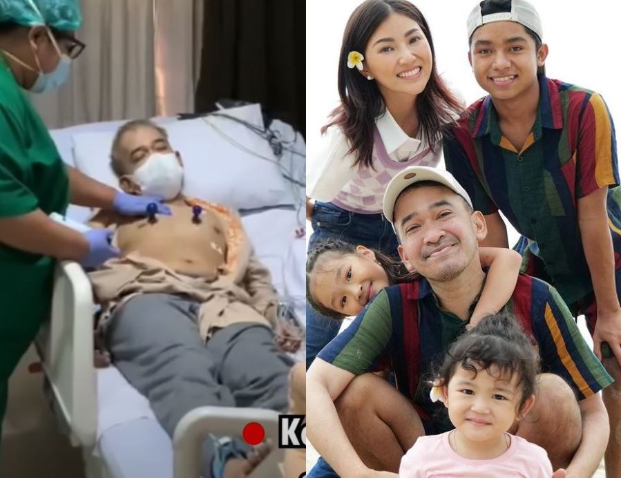 Berita terpopuler Wellness (7/6/2022): penyebab dan gejala darah rendah seperti dialami Ruben Onsu. Hingga perbedaan minat dan bakat pada anak.