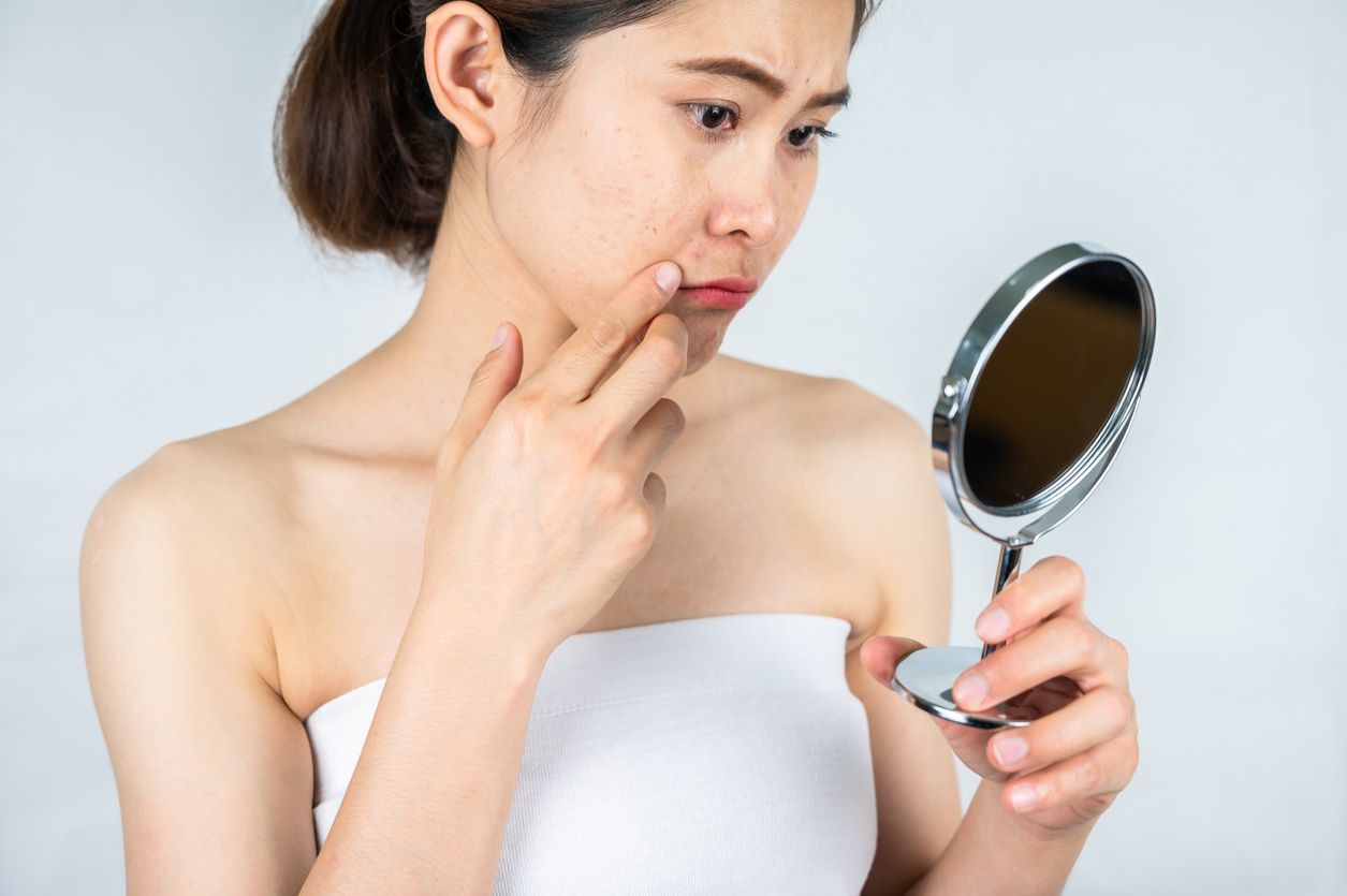 Hindari lima kesalahan saat memakai skincare berikut ini karena bisa memicu munculnya breakout di wajah.