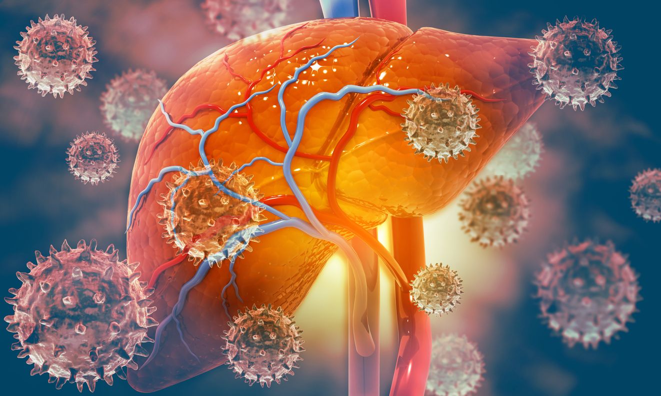 Memperingati Hari Hepatitis Sedunia 2022, penting untuk mengetahui perbedaan kelima jenis hepatitis agar lebih waspada. Yuk, simak selengkapnya!