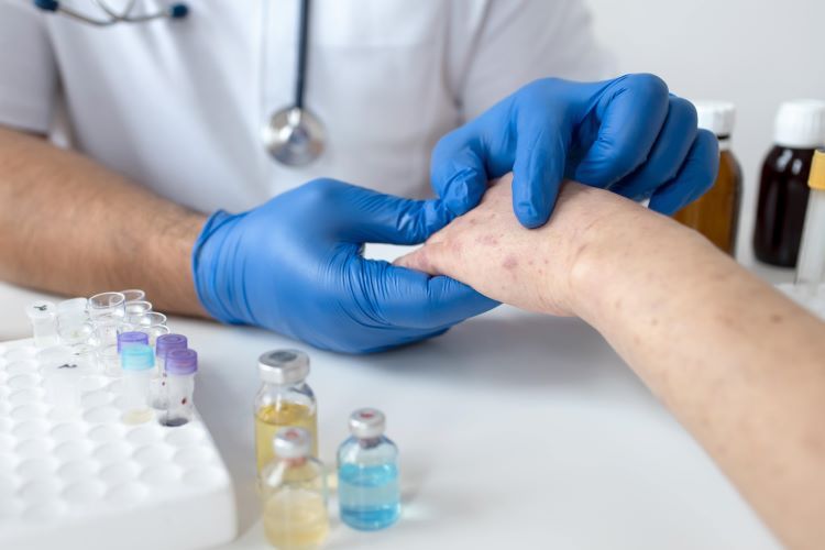 Kementerian Kesehatan (Kemenkes) mengumumkan adanya suspek monkeypox atau cacar monyet di Jawa Tengah. Kenali penularannya dari orang ke orang.