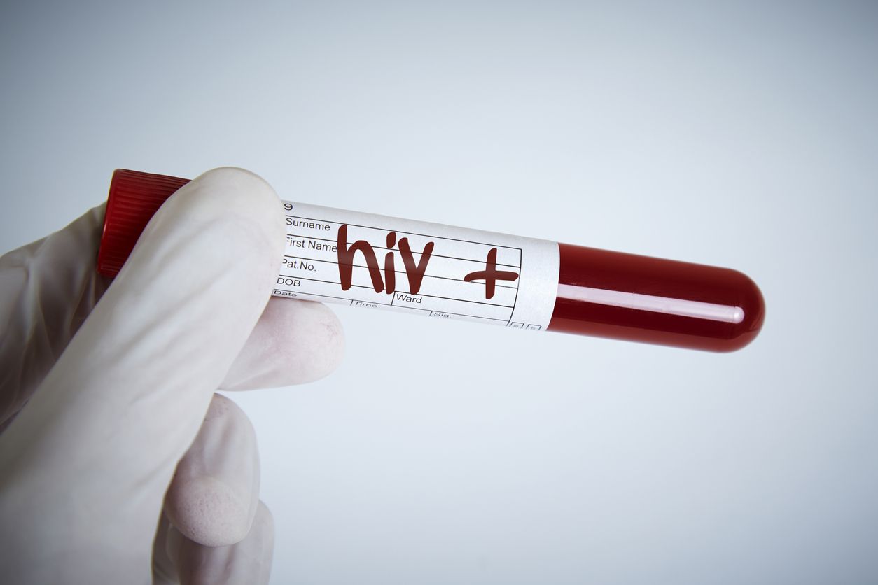 Orang dengan HIV yang tidak diobati bisa mengalami infeksi oportunistik, apa itu? Yuk simak kondisi lengkapnya