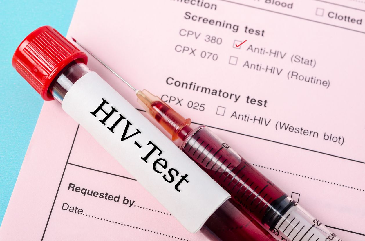 Berikut ini tiga langkah yang harus dilakukan agar kamu terhindar dari HIV, salah satunya hindari perilaku seks berisiko