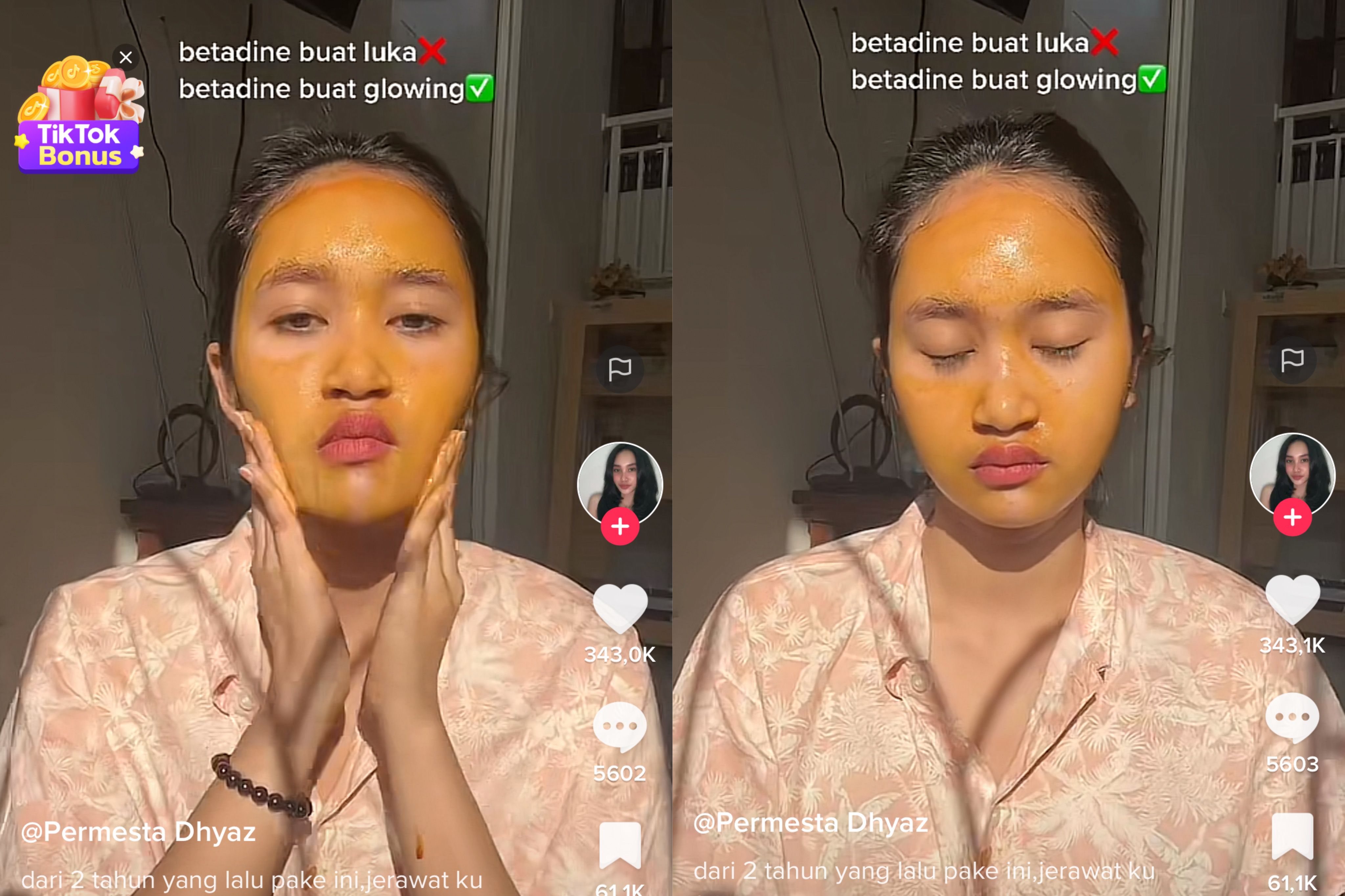 Viral di TikTok video yang menunjukkan penggunaan betadine untuk mengatasi jerawat. Apakah benar efektif?