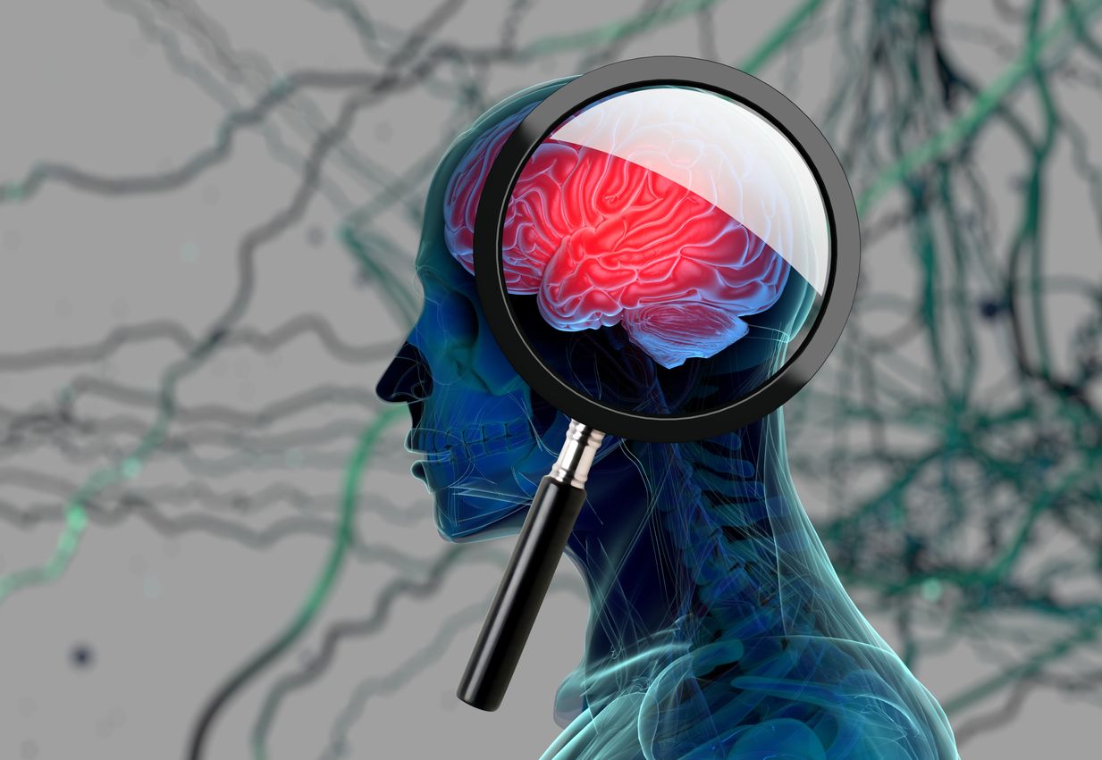 Dokter mengungkap kalau pasien hipertensi berisiko mengalami demensia,  berikut ini penjelasan lengkapnya