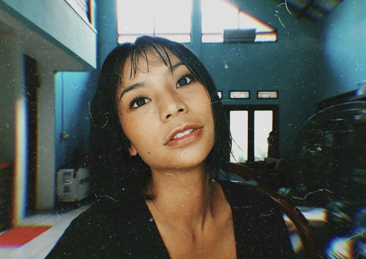Aktris sekaligus model Shareefa Daanish menceritakan pengalamannya melawan adult acne. Ia mengaku sempat merasa insecure akibat jerawat tersebut.