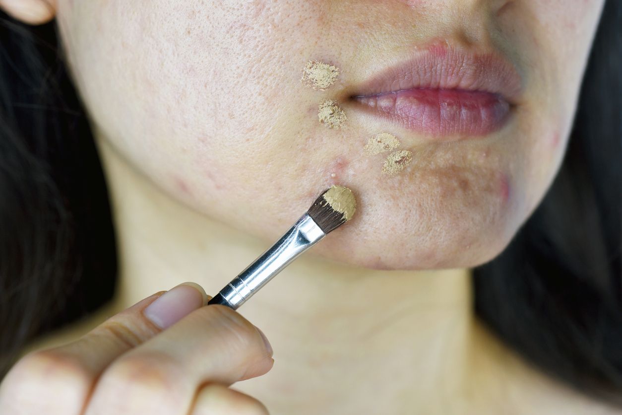 Baru-baru ini viral di TikTok trik makeup terbaru untuk menutupi jerawat yang disebut dengan sticky method. Apa itu?