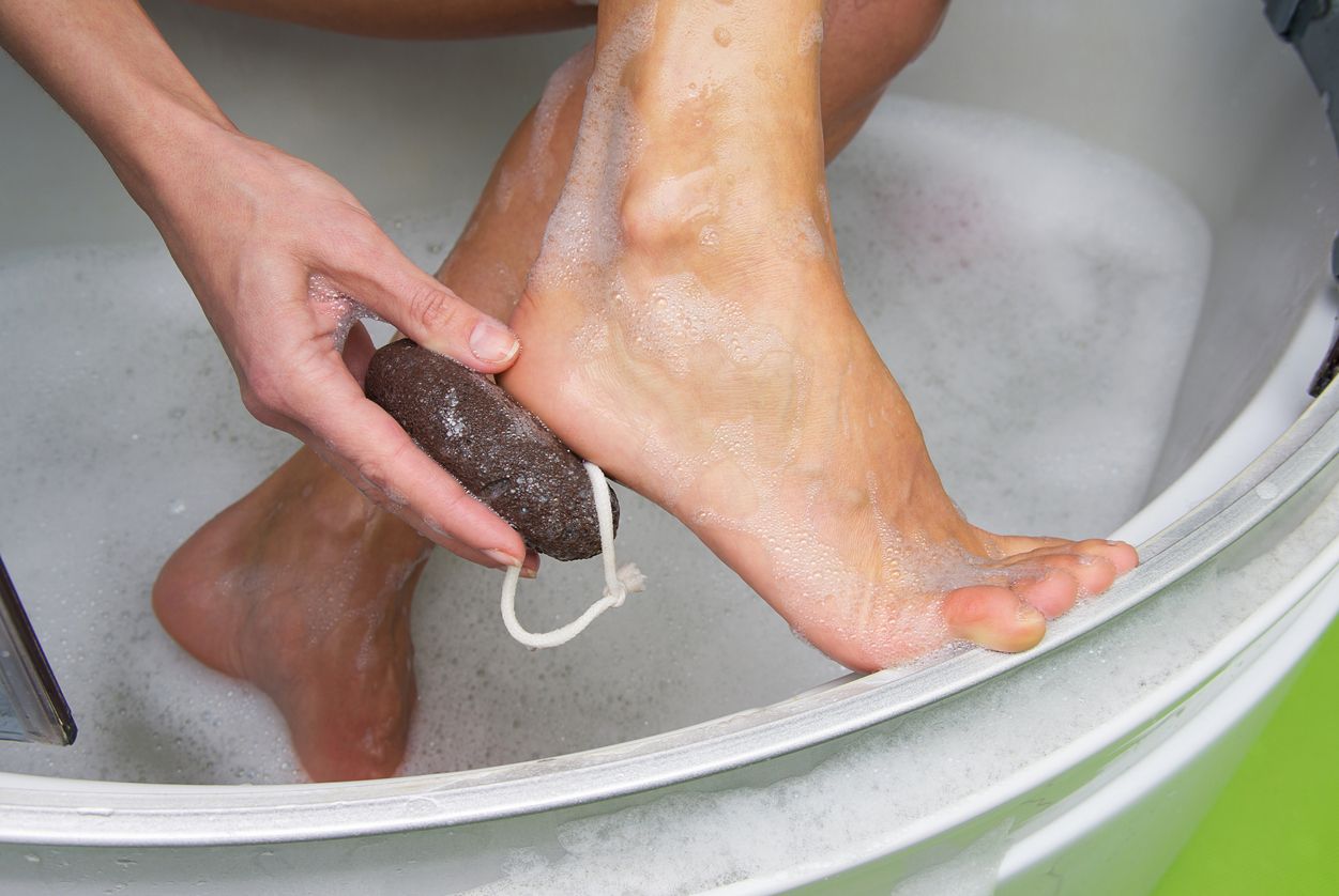 Berikut ini empat langkah mudah mengatasi kapalan di rumah, mulai merendam dengan air hangat hingga pakai kaus kaki.