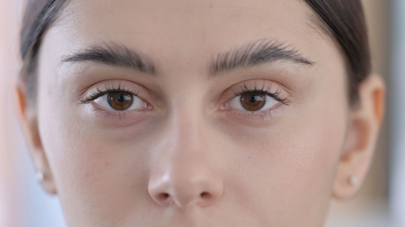 Tak hanya menangis, 10 hal berikut ini juga bisa menyebabkan puffy eyes atau mata bengkak. Apa saja?