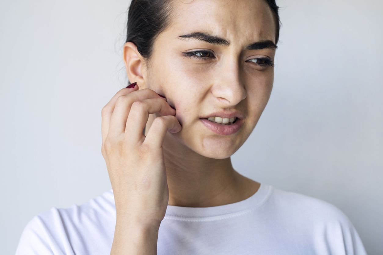 Kulit sensitif sangat rentan reaksi alergi seperti gatal. Ini rekomendasi serum wajah yang bisa redakan gatal bagi kulit sensitif.